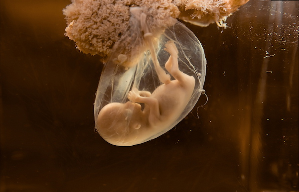 What is the difference between an embryo and a fetus?