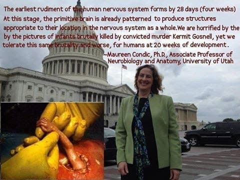Thumbnail for Dr Maureen Condic Congressional Testimony: Fetal Pain at 8 Weeks...