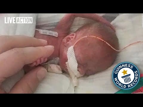 Thumbnail for Meet The Youngest Premature Baby To Ever Survive