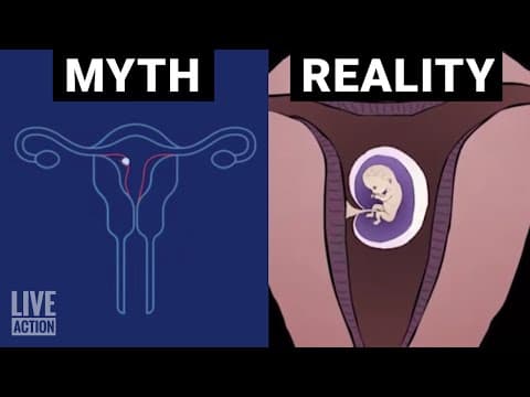 Thumbnail for The Abortion Pill Inaccurately Described by Planned Parenthood