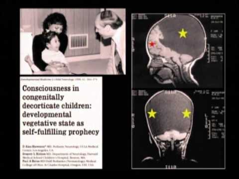 Thumbnail for 2013 0532 Dr. Condic Testimony