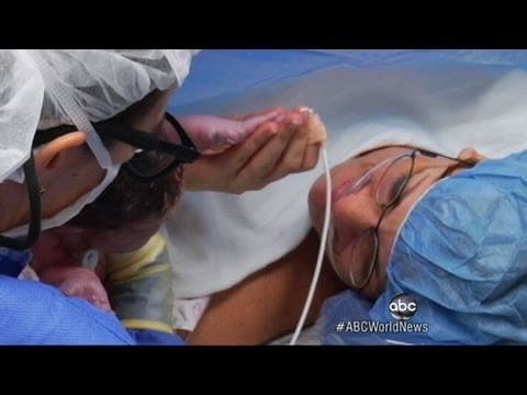 Thumbnail for Miracle Baby: Heart Surgery Before Birth Saves Baby's Life