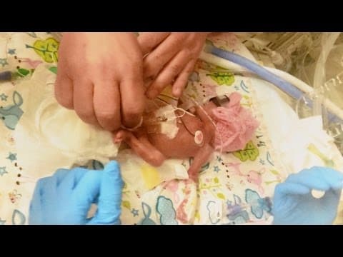 Thumbnail for Baby Born at 24-Weeks With Feet The Size Of Pennies Beats All Odds