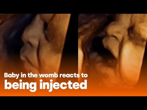 Thumbnail for Baby reacts to injection