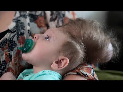 Thumbnail for Bentley's Second Chance | Boston Children's Hospital