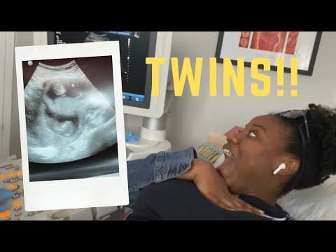 Thumbnail for WE’RE HAVING  TWINS!! Our shocking reaction