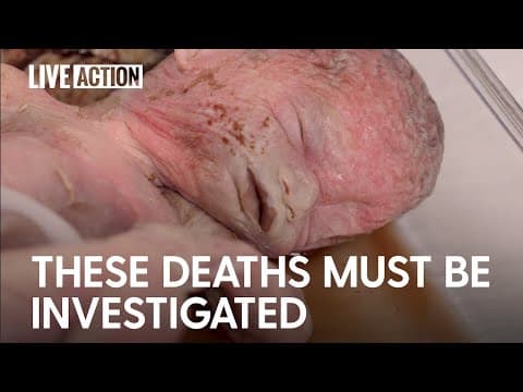 Thumbnail for Discovered infant bodies may indicate infanticide after attempted abortions [GRAPHIC CONTENT]