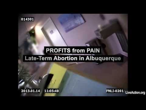 Thumbnail for Profits from Pain: Late-Term Abortion in ABQ