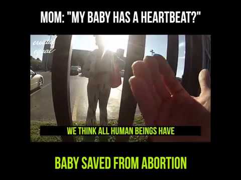 Thumbnail for Baby Saved When Mom Hears Baby Has Heartbeat