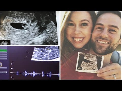 Thumbnail for 6 WEEK ULTRASOUND - HEARING THE HEARTBEAT | VLOG