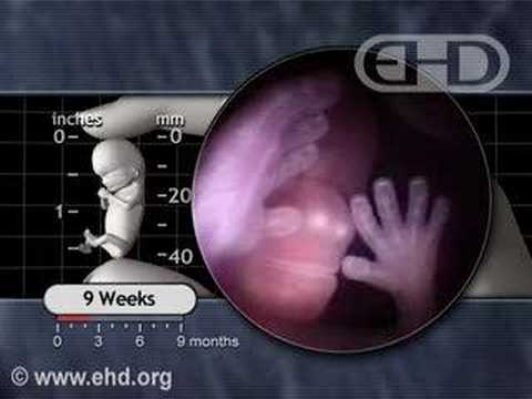 Thumbnail for Fetal Development -- The Eyelids Close