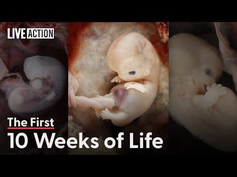 Thumbnail for This Is The First 10 Weeks Of Human Life