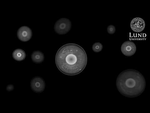Thumbnail for Amniotic fluid is a rich source of stem cells – that can now be harvested