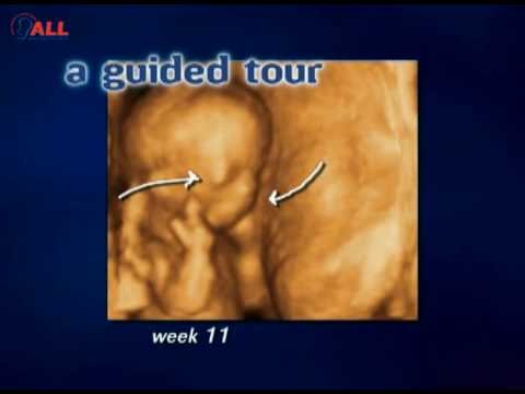 Thumbnail for Baby Steps: 4D Ultrasound