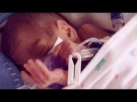 Thumbnail for Born at 22 weeks, baby Thomas is happy and healthy