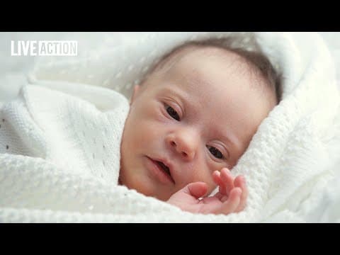 Thumbnail for Protect Babies With Down Syndrome