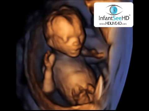 Thumbnail for 16 WEEK HD LIVE 4D ULTRASOUND