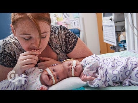 Thumbnail for Conjoined Twins Abby and Erin Delaney: A Year in the Life