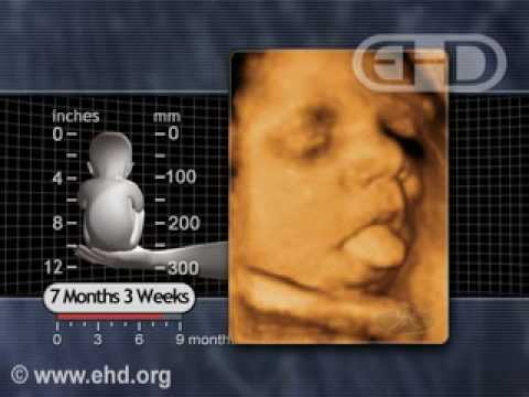 Thumbnail for Fetus 7 1/2 months -- Breathing Movements