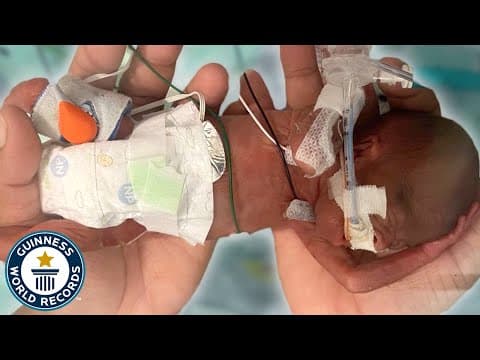 Thumbnail for Most Premature Baby - Guinness World Records