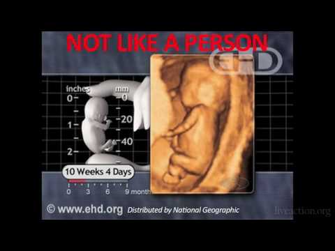 Thumbnail for Indiana Planned Parenthood Caught On Tape Giving Fabricated Medical Information