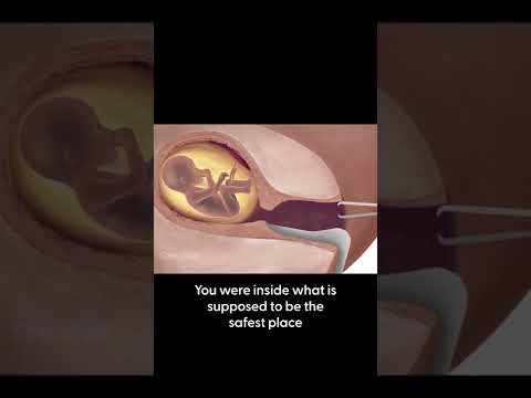 Thumbnail for Abortion Is Not A Valid Choice - Killing A Child Is Wrong