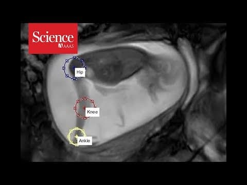 Thumbnail for Snippet: Tracking fetal movements at 24 weeks
