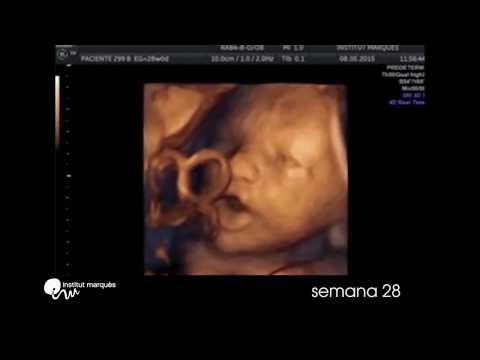 Thumbnail for INSTITUT MARQUÈS - Response of the fetus to intravaginal music
