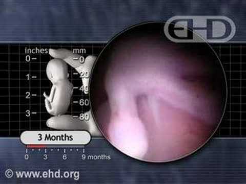 Thumbnail for 3 Months Pregnant: End of the first trimester