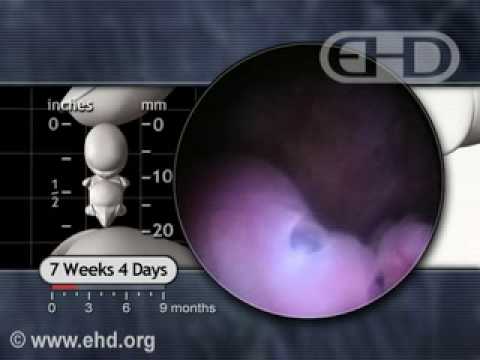 Thumbnail for Eyes and Hands: 7 1/2 Weeks Pregnant