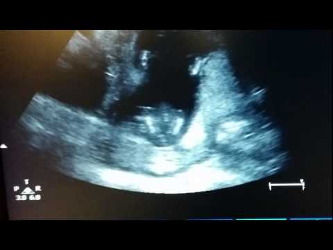 Thumbnail for Clap your hands, baby announcement.