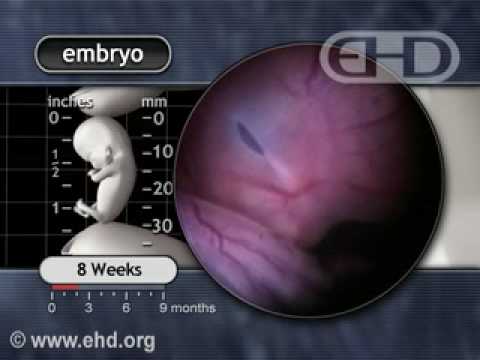 Thumbnail for The Human Embryo Eight Weeks After Conception