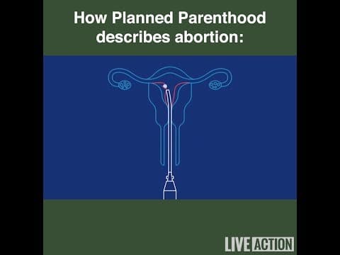 Thumbnail for Suction abortion inaccurately described by Planned Parenthood