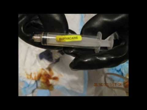 Thumbnail for Illegal Dumping at Carhart's Maryland Late term Abortion Clinic 2012