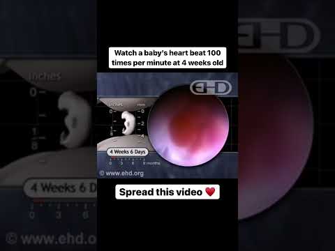 Thumbnail for An Unborn Baby's Heart Beating At 4 Weeks Old | Human Development