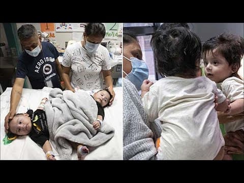 Thumbnail for 'God's gift': Once conjoined twins leave TCH to begin new life