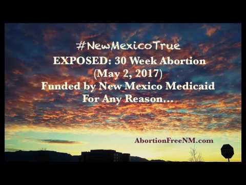 Thumbnail for Exposed 30 Week Late Term Abortion New Mexico