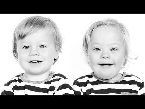 Thumbnail for #NobodyToldMe The truth about Down syndrome