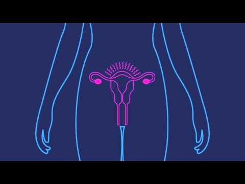 Thumbnail for How Effective is the Birth Control Shot | Planned Parenthood Video