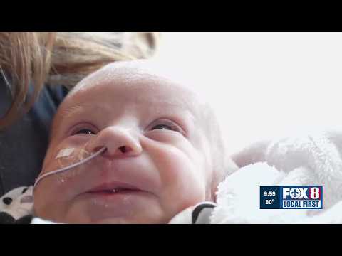 Thumbnail for Parents plan funeral for baby with heart defects, but she miraculously survives