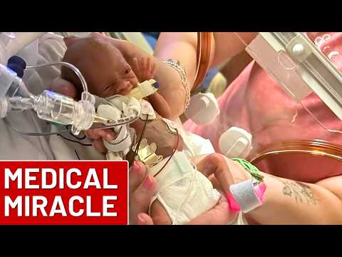 Thumbnail for Baby born 16 weeks early weighing less than a soda can