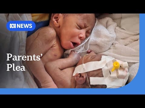 Thumbnail for PNG conjoined twins should not be separated due to risk of death, doctors say | ABC NEWS