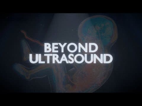 Thumbnail for Beyond Ultrasound: The Journey Of Human Development in the Womb