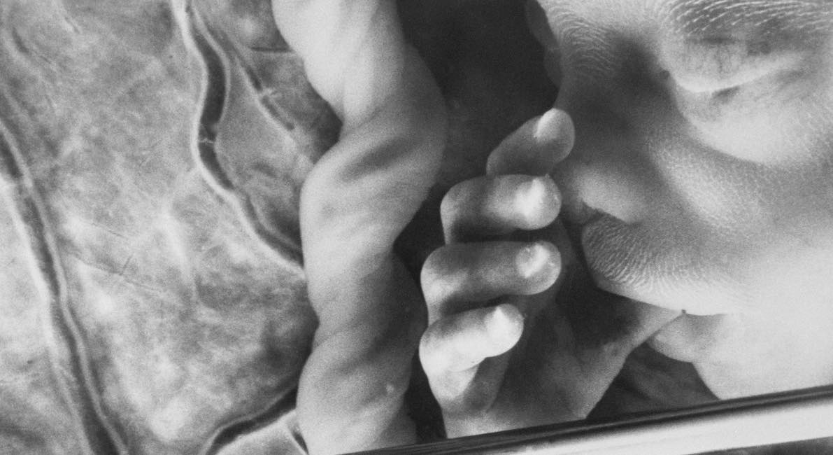 'You may see a head, arms, or legs': Group instructs how to use abortion pill past FDA limits