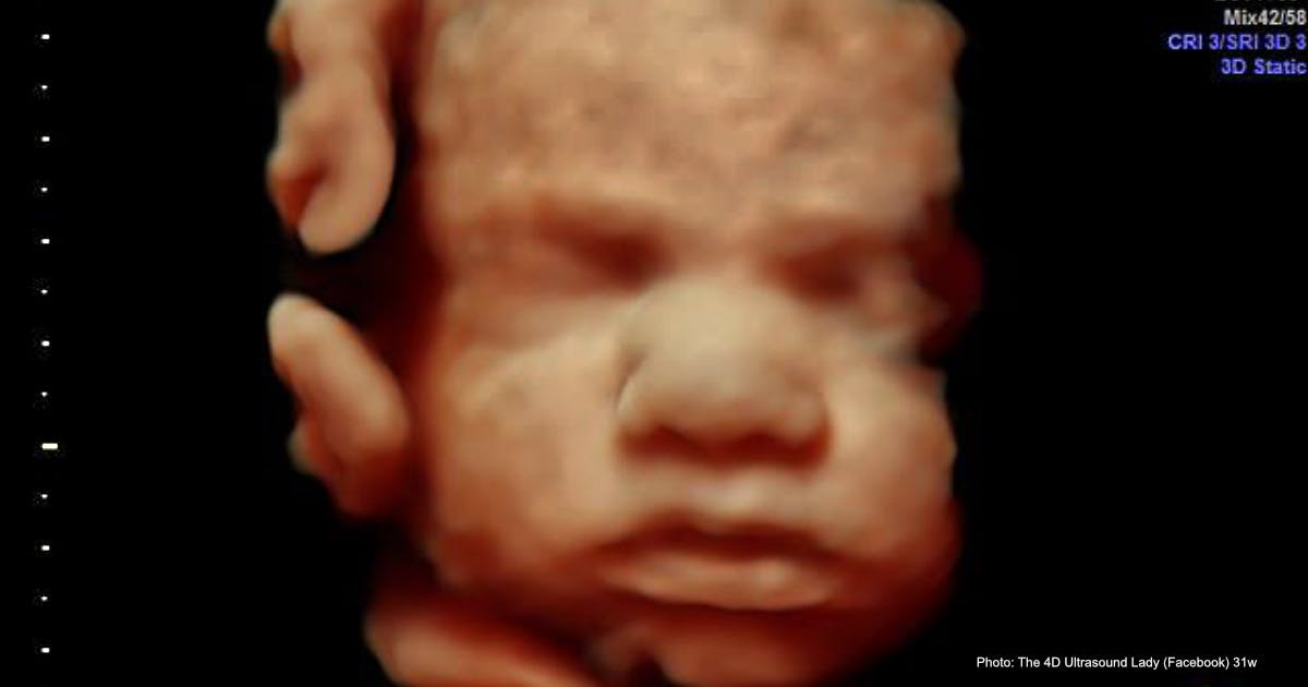 31-week baby found in toilet after North Carolina woman takes abortion pill