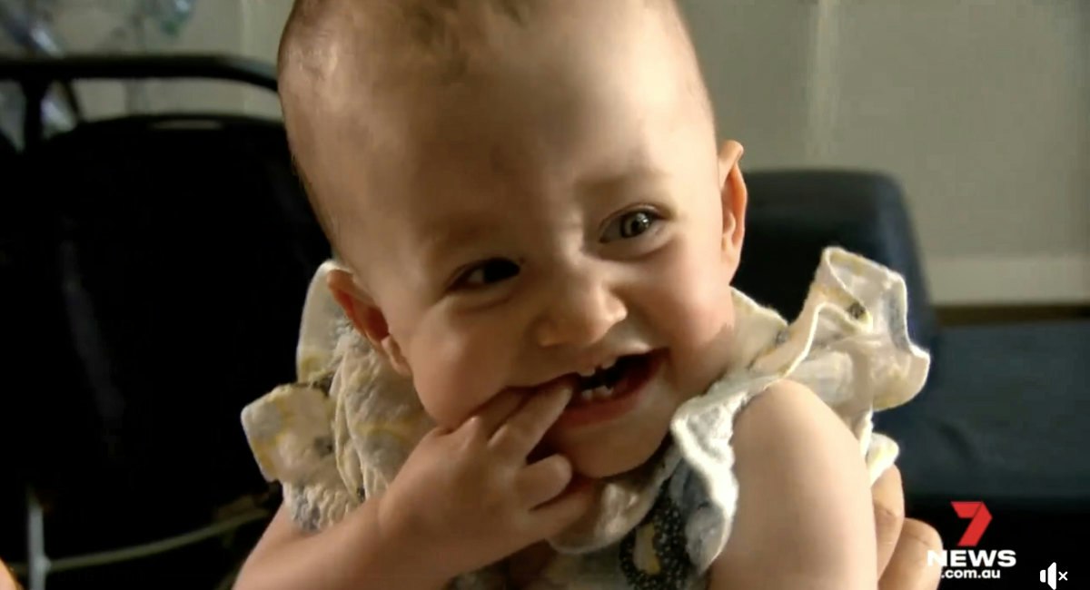 Baby girl given 30 minutes to live celebrates her first birthday | Live ...