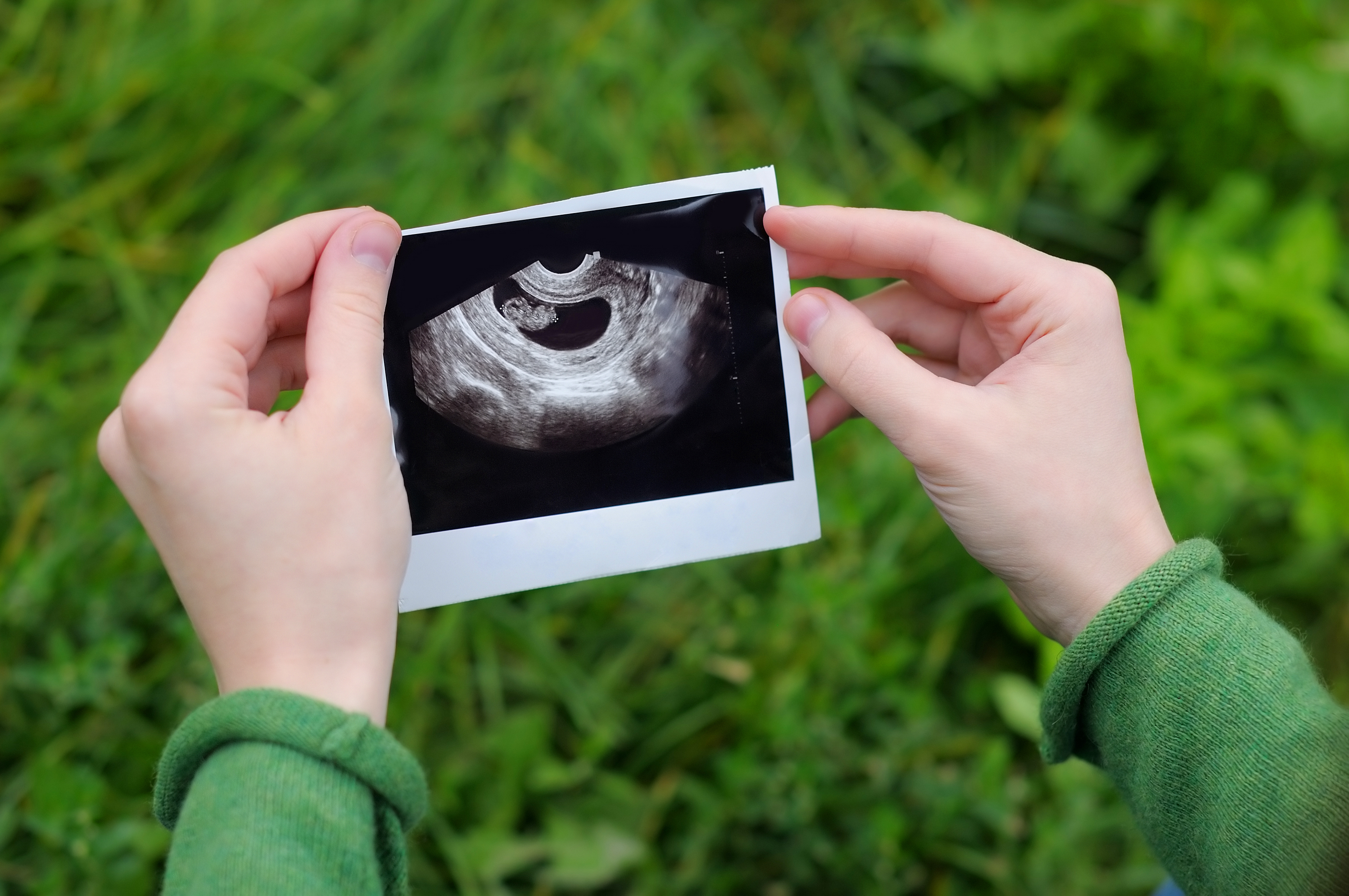 Illustrative ultrasound image used by a source covering Ashley’s testimony