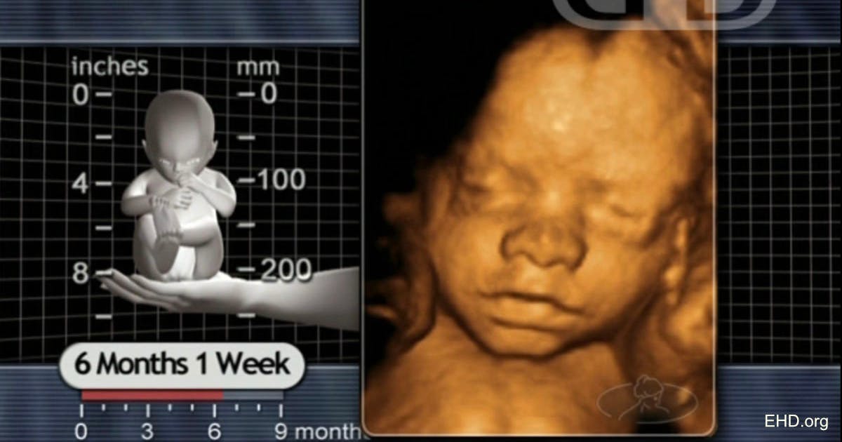 Groundbreaking in-utero surgery saves preborn baby from rare tumor