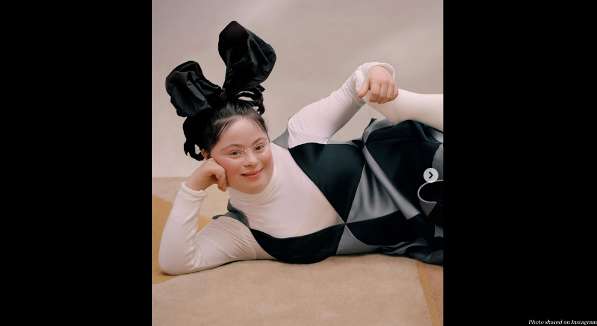 Groundbreaking model with Down syndrome graces the digital cover of ...