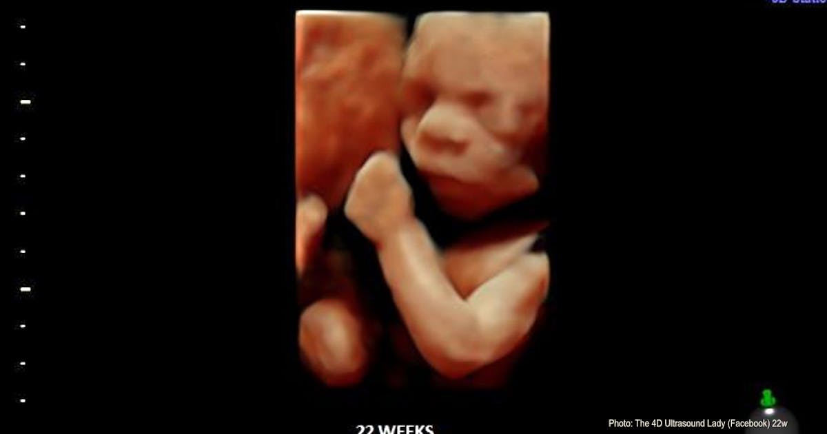 Couple sues surrogate who saved their baby's life by refusing to abort